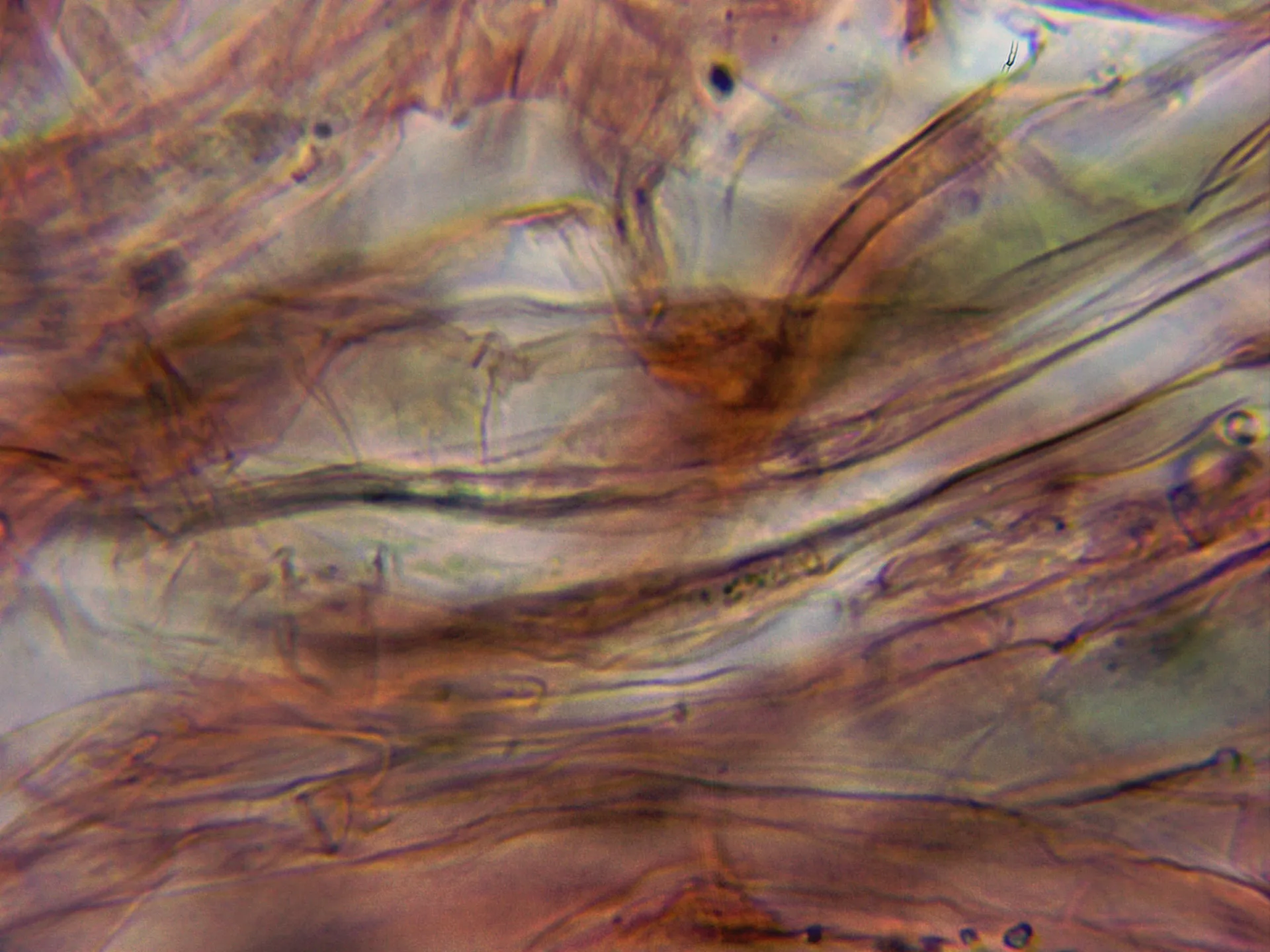Microscopía de Pluteus cervinus - 10 - Cutícula